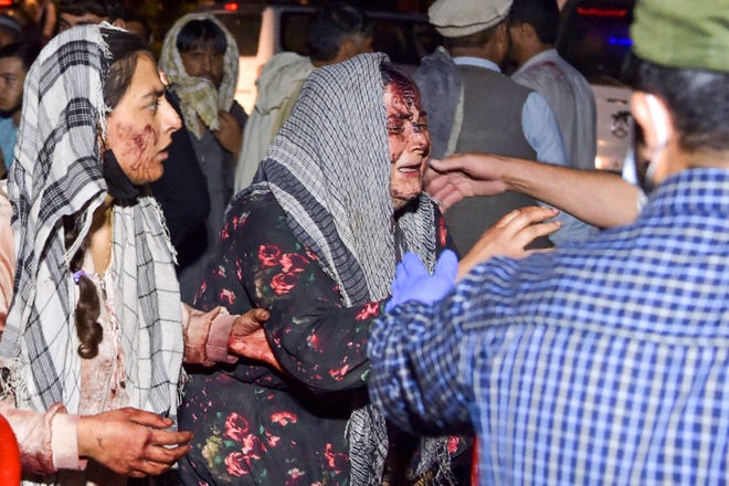 Wounded women arrive at a hospital for treatment after two blasts, which killed at least five and wounded a dozen, outside the airport in Kabul on August 26, 2021.